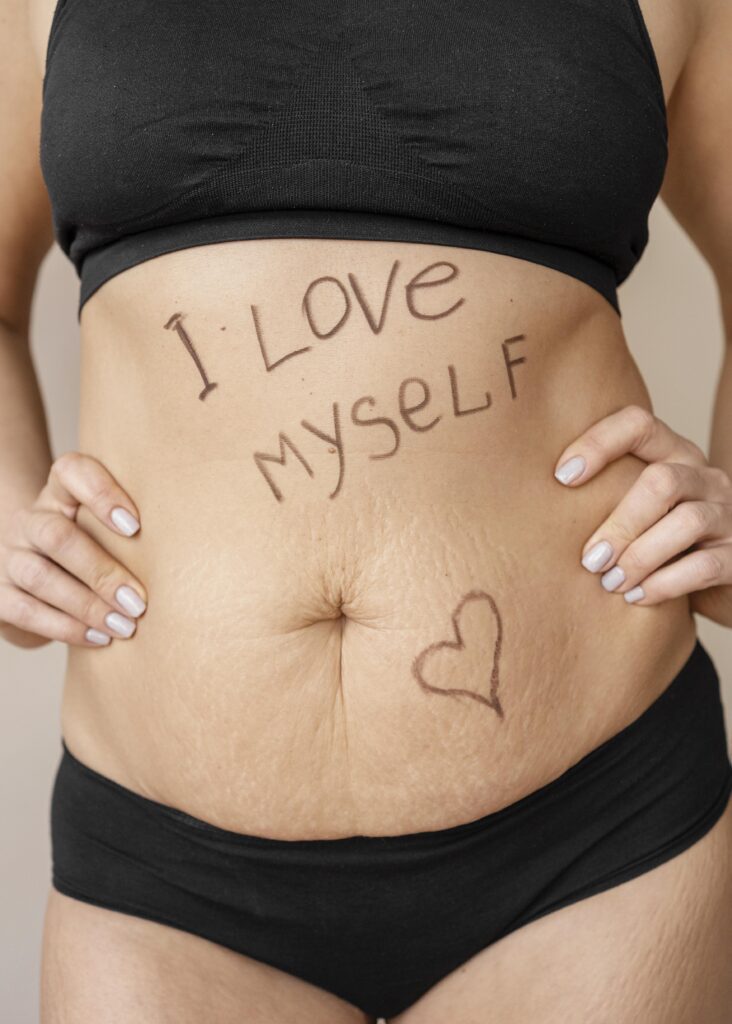 ventre de femme post partum avec écrit dessus "I love myself"
