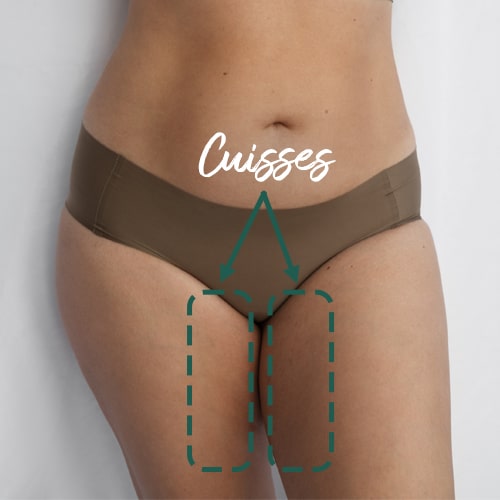 Cuisses femme etourées
