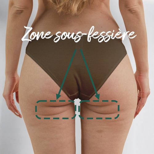 zone sous fessiere femme